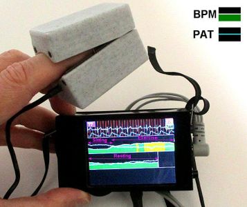 ECG With PPG Using Arduino : 9 Steps (with Pictures) - Instructables
