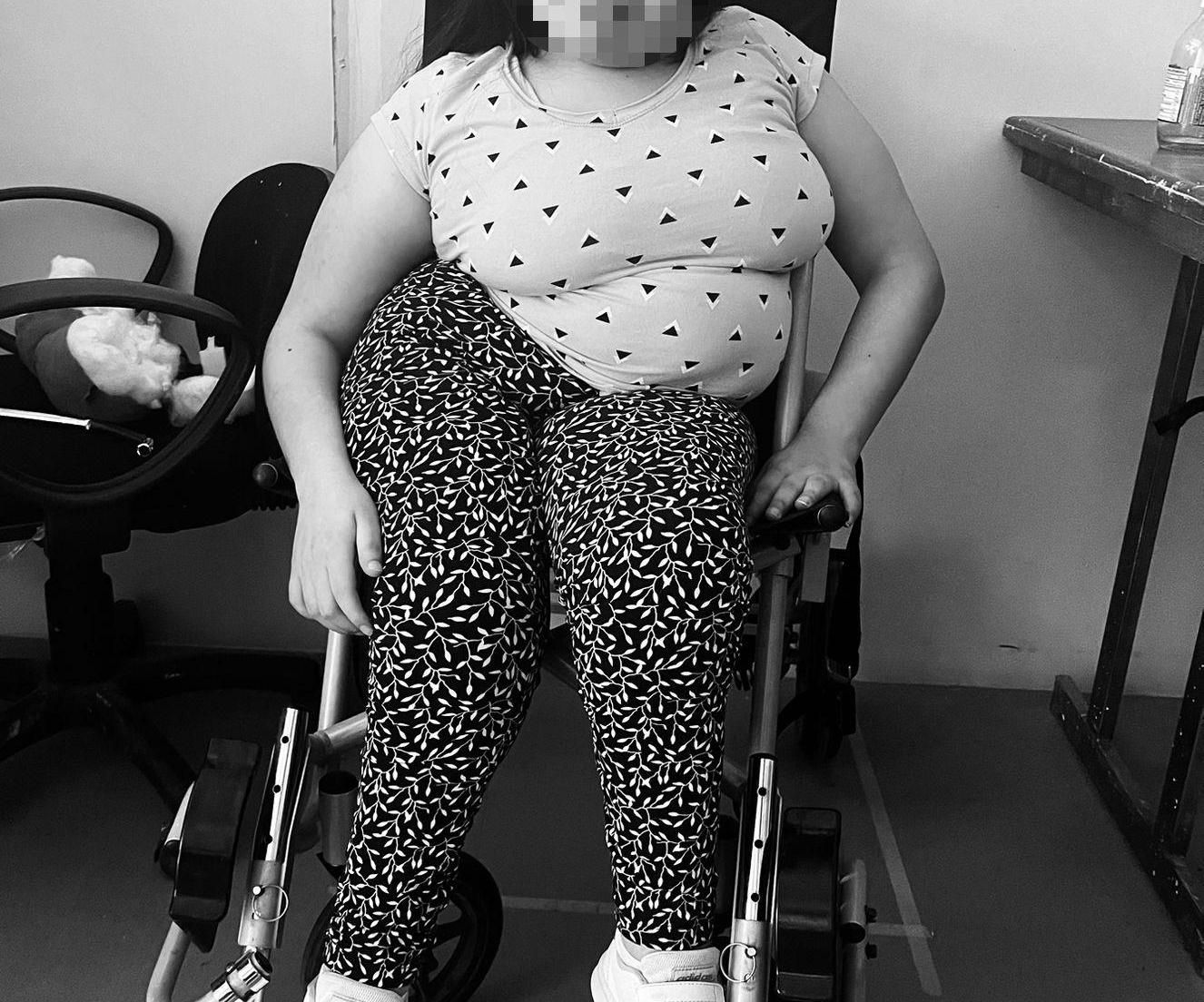 Elaboration of Lateral Trunk Supports for a Wheelchair User With Scolosis