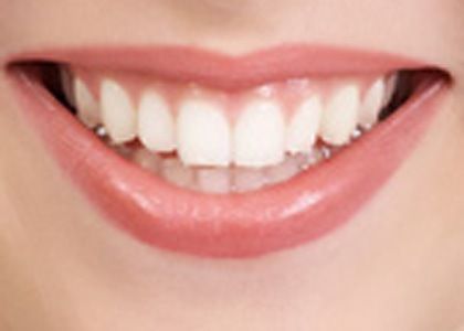 How to Have a Healthy Smile?