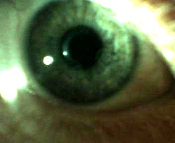 Imaging Your Eyes With a Webcam