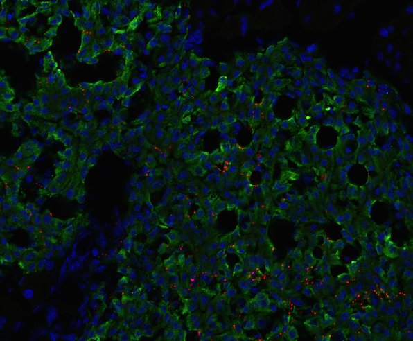 How To Measure Fluorescence from IF Stianing