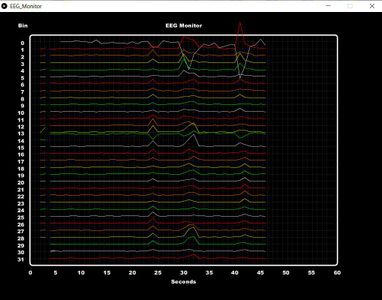 Mind Control 3: EEG Monitor : 7 Steps (with Pictures) - Instructables