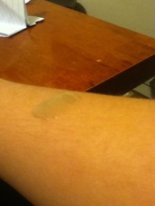 Arm Sanitizer 