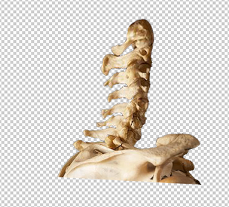 The Skull, Wound and the Spine