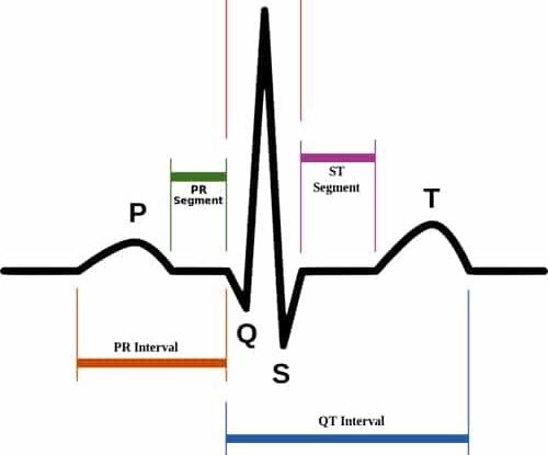 ECG Circuit and Heart Rate Digital Waveform Monitor 