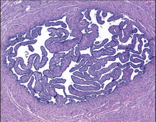 Specimen Processing Structure and Its Insights