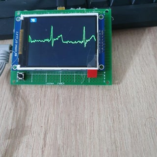 ECG Display With Arduino : 13 Steps (with Pictures) - Instructables