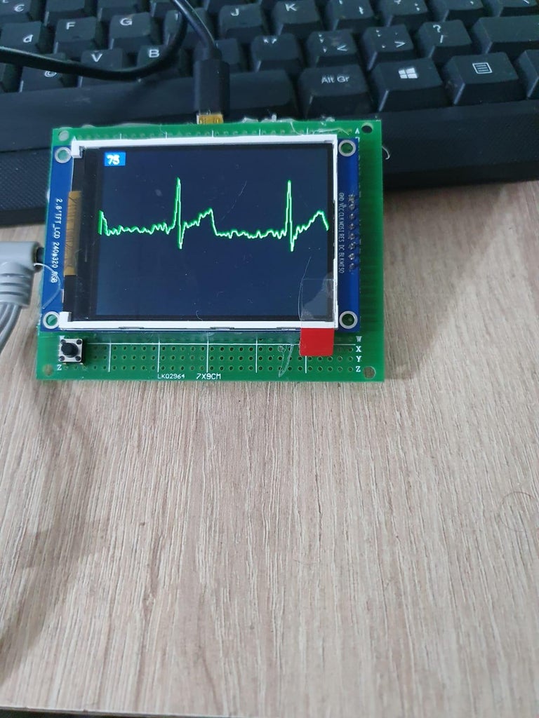 ECG Display With Arduino : 13 Steps (with Pictures) - Instructables