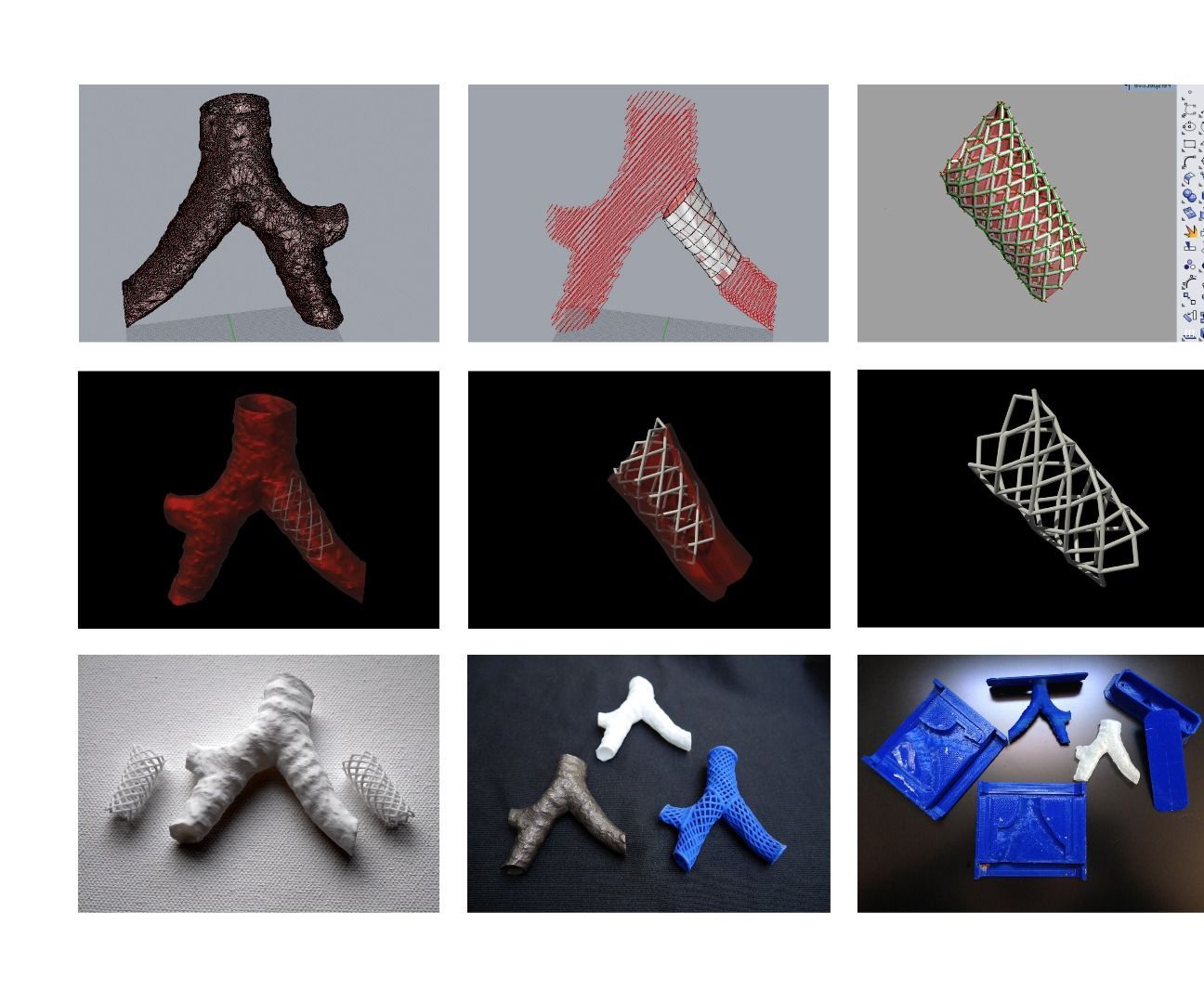 Create a Custom 3D Printable Prosthetic Device Using Data From a CT Scanner