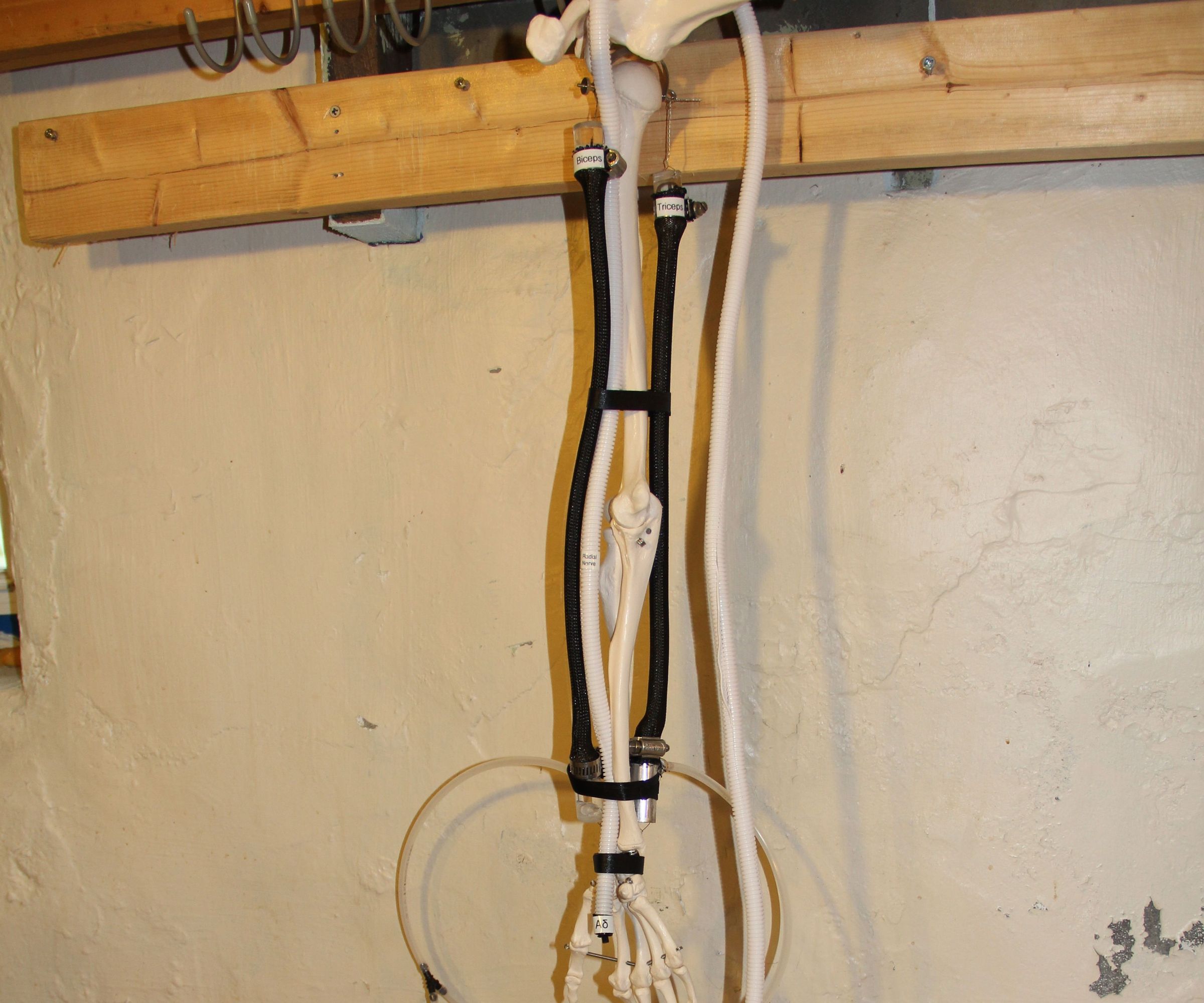 Arduino Mechanotronic Human Pain Reflex