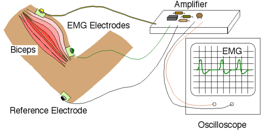Electromyography Electrode