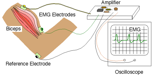 EMG Sensing Circuit : 7 Steps - Instructables