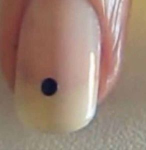 Dot 