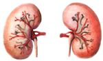 Flu Associated With Acute Renal Failure