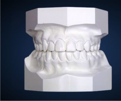 Plaster Trap
