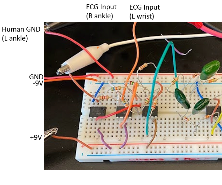 Designing an ECG