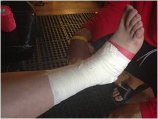 How to Tape an Ankle (Like a Trainer)