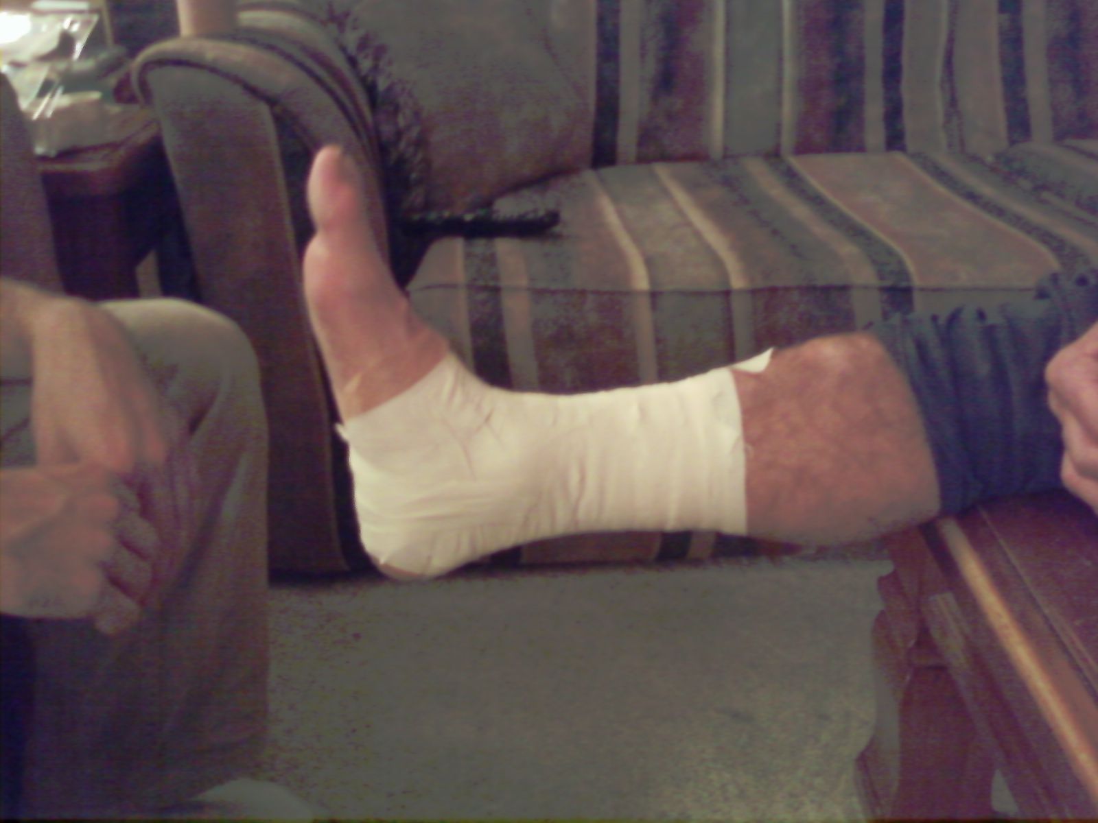 How to Tape an Ankle