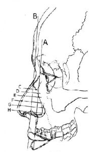 Estimation of the Nose