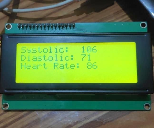 Blood Pressure Measurement Using Arduino