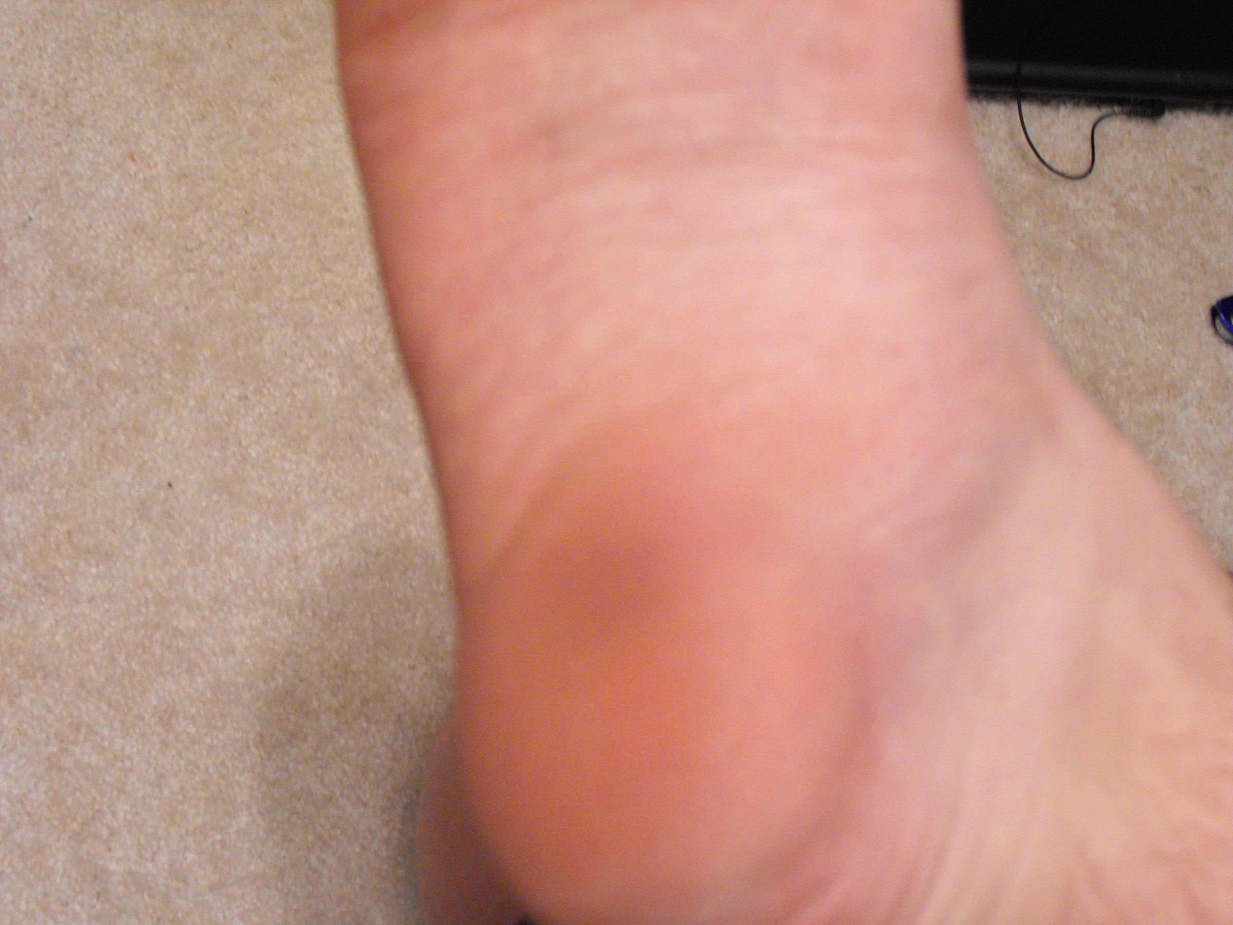 How to Make Your Flip Flops Better