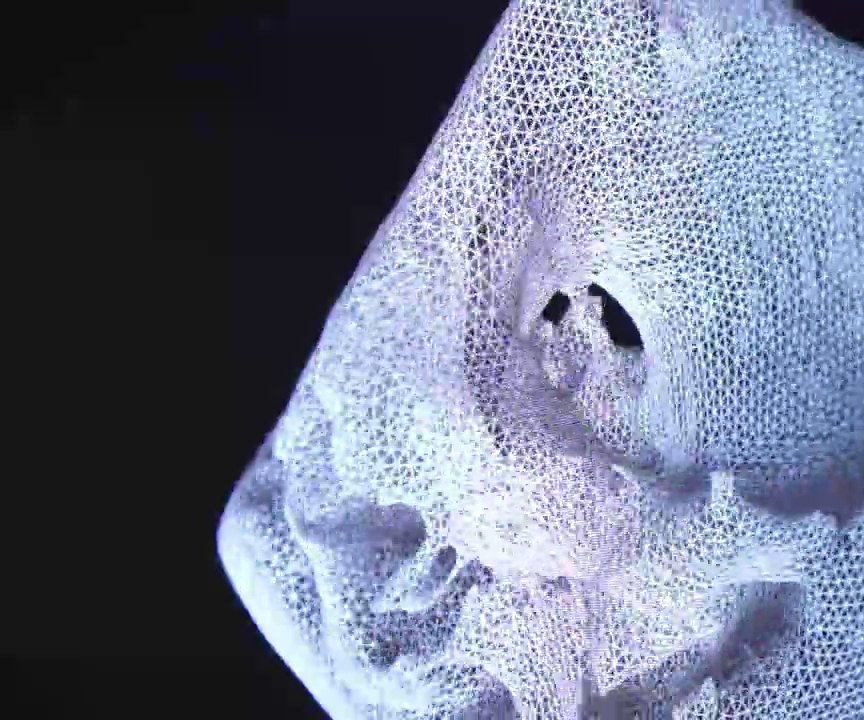 Print Your Heart : 3D Models for Cardiac Valve Disease