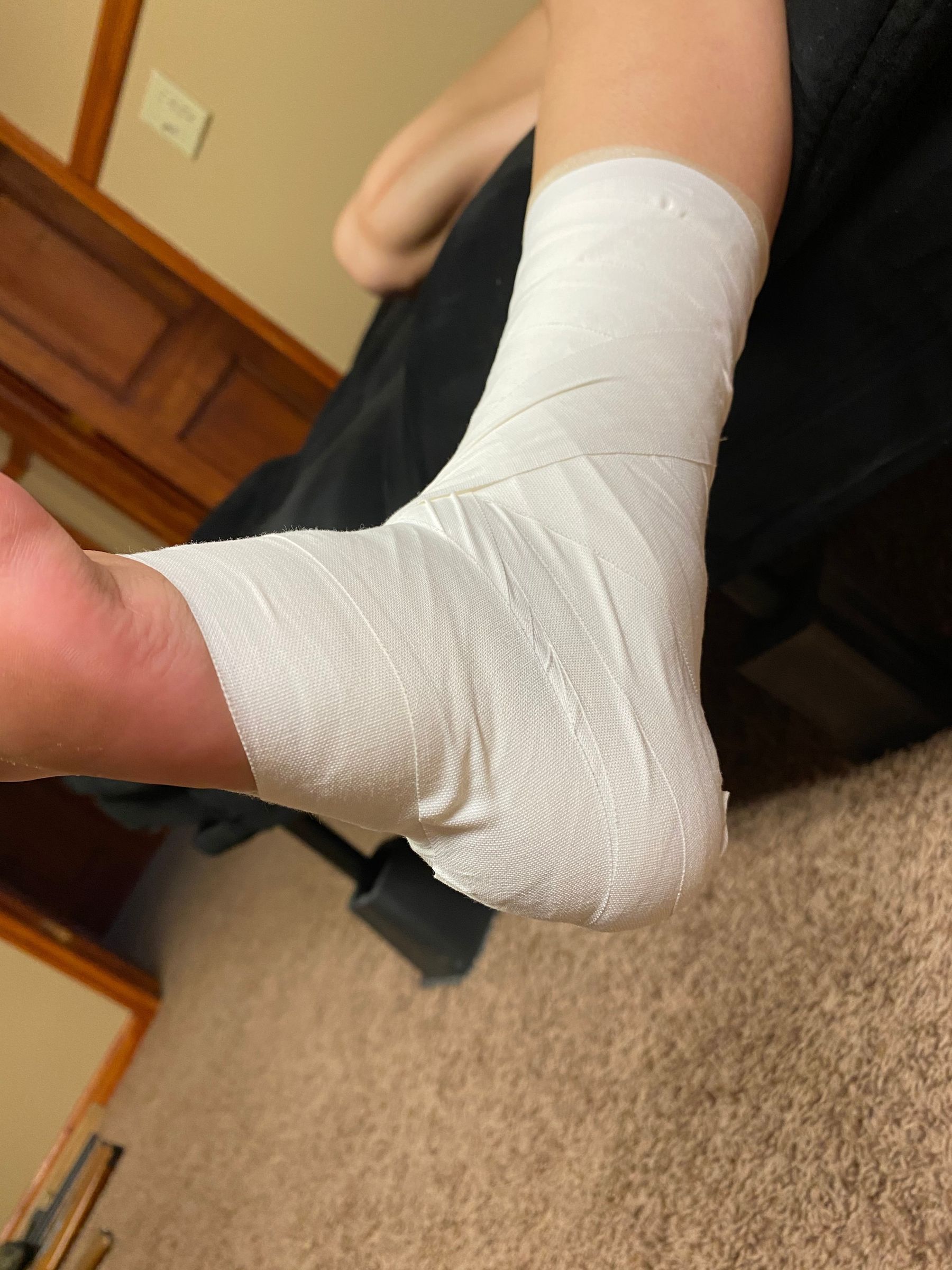 How to Tape an Ankle 6 Steps Instructables