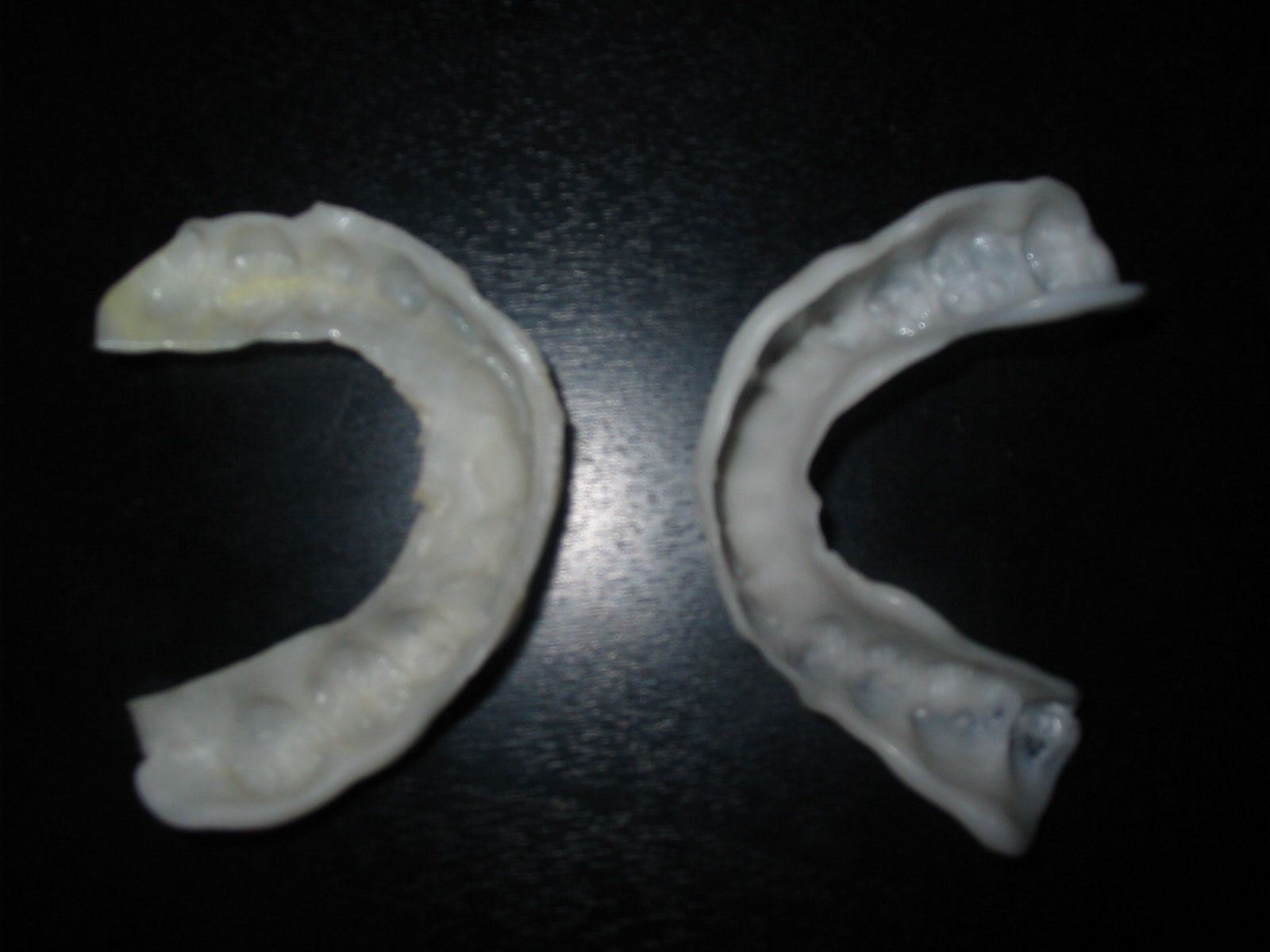 Make a Night Time Orthodontic Retainer