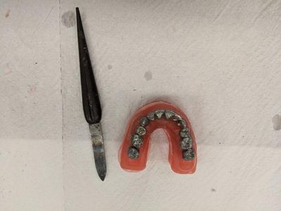 Remove Metal Teeth