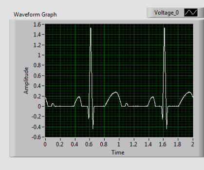 Simple ECG Recording Circuit and LabVIEW Heart Rate Monitor