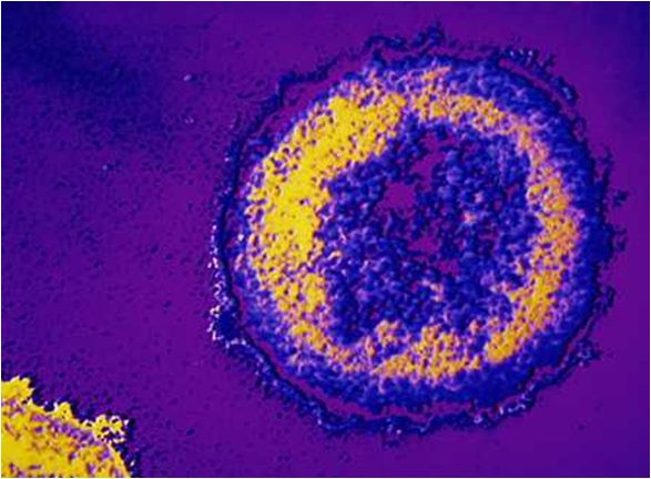 Blood Borne Pathogens