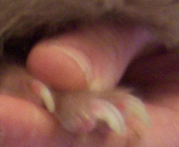 Assess Nail Condition