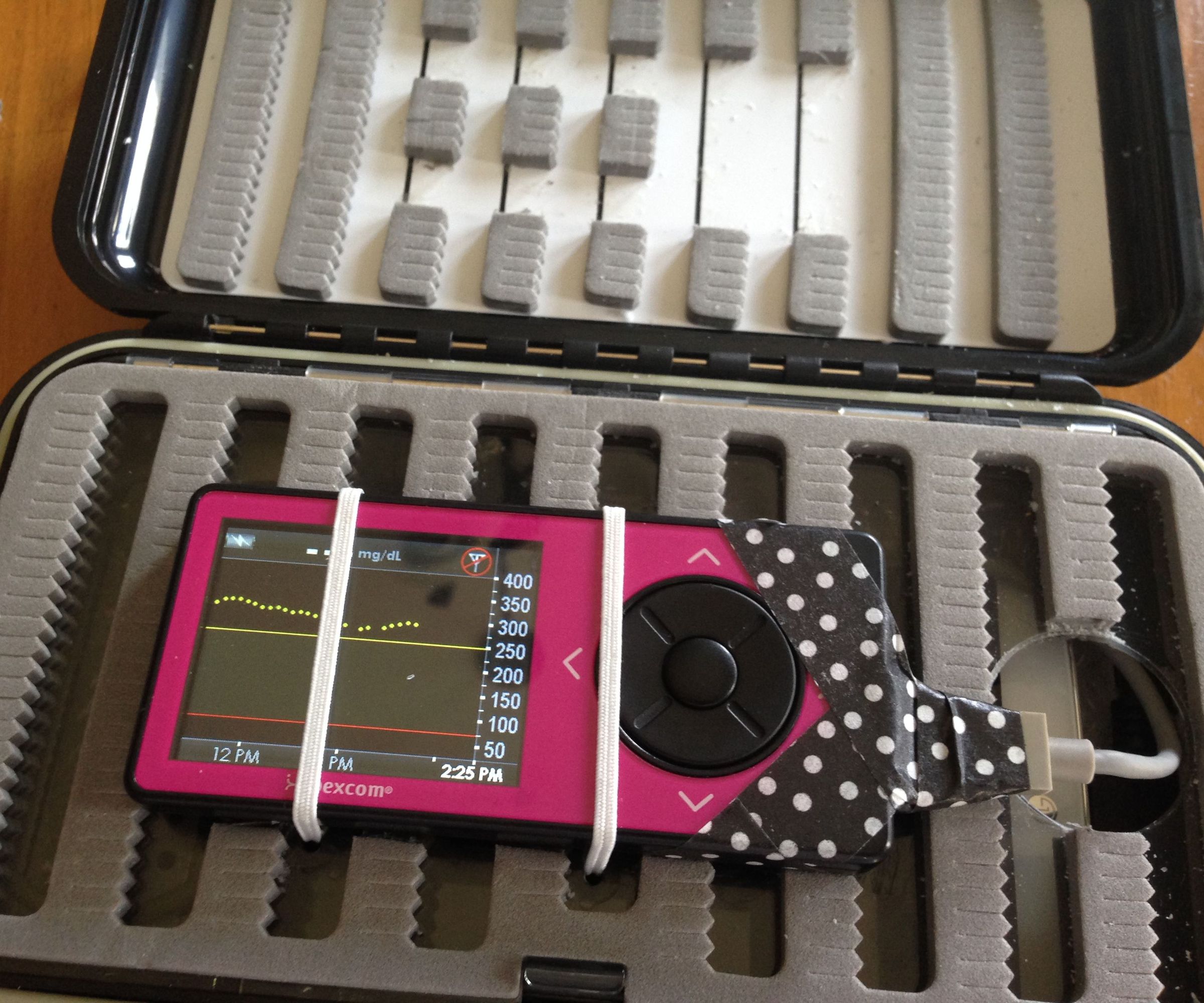 Hardened Case for CGM Nightscout Users