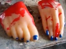 Life Casting: Severed Limb Project