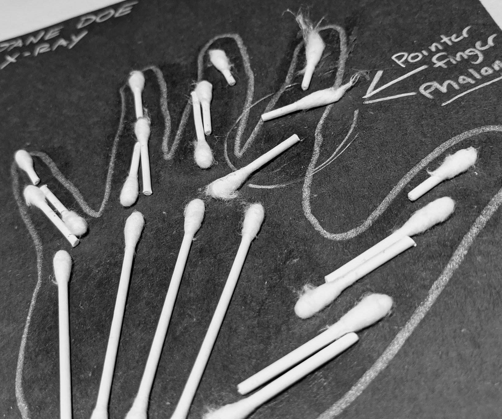 X-ray: Bones of the Hand