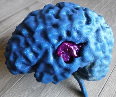 MRI to 3D Printable File