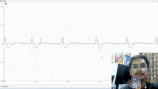 Eye Blink Detection by Recording EOG Using BioAmp EXG Pill