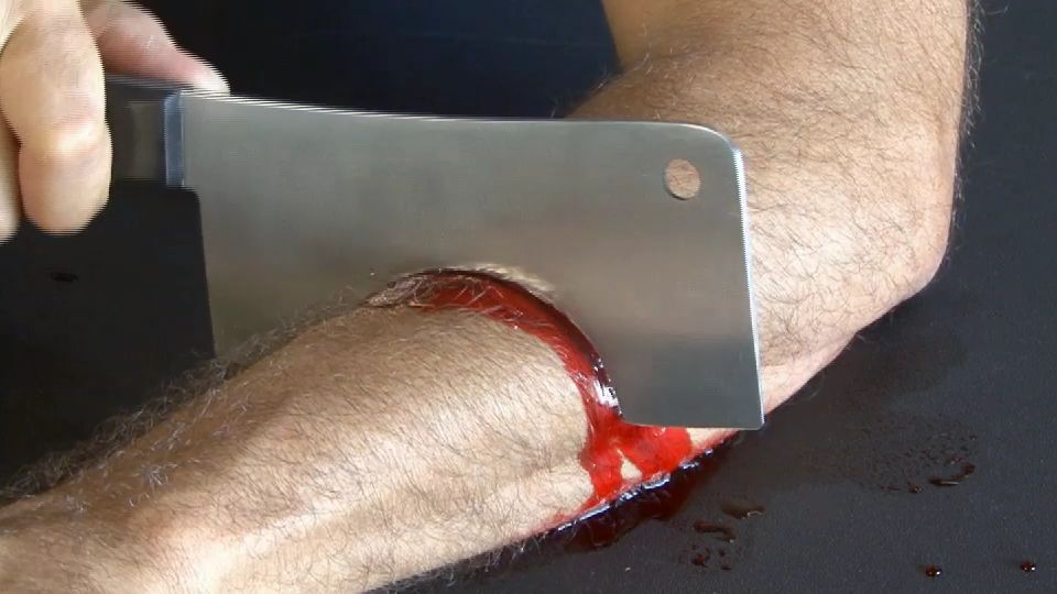 Blood Spurting Knife Wound