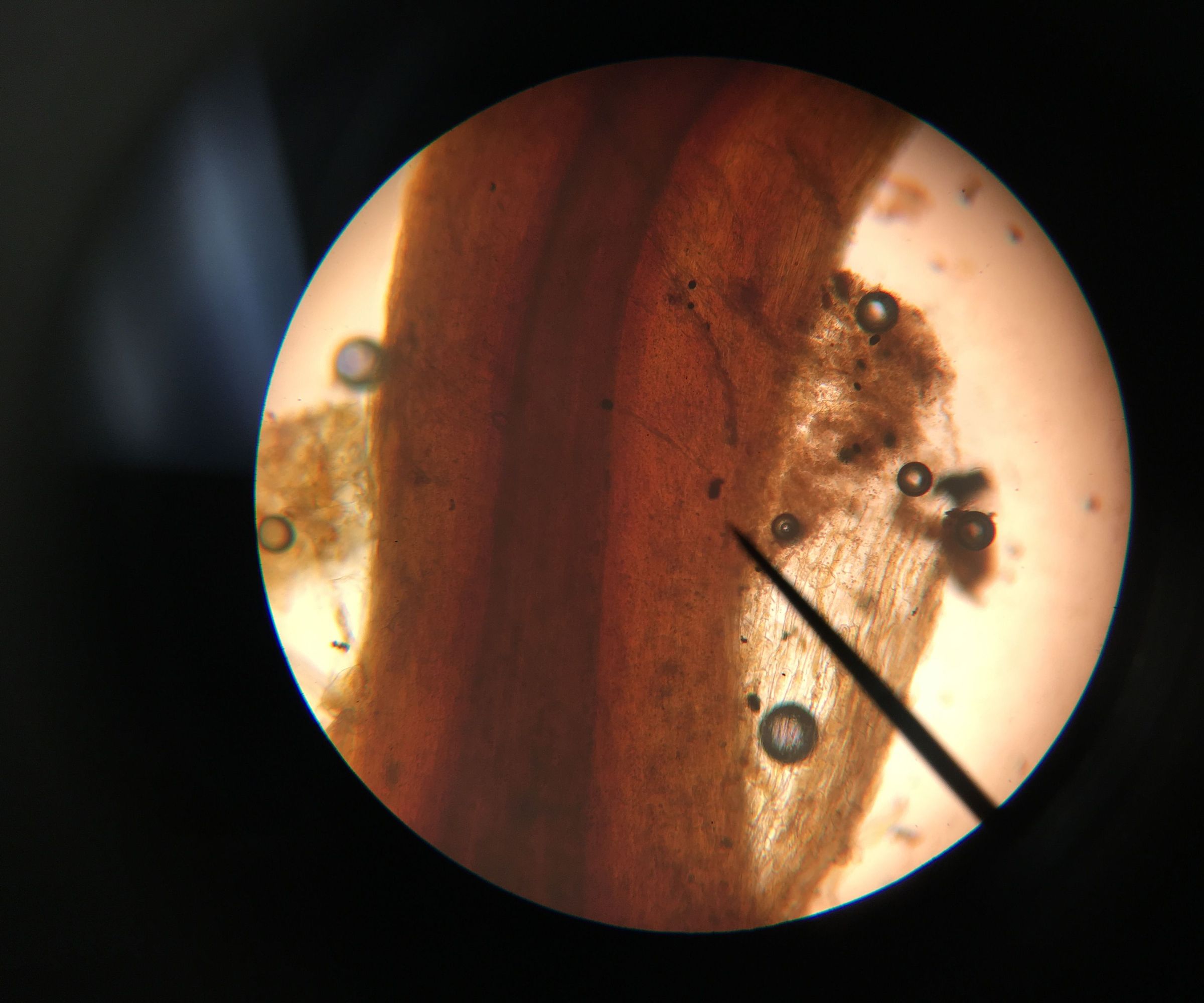 Les Racines Et Les Poils Absorbantes