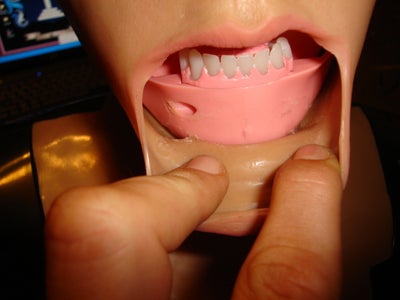 Finnishing the Skin Removal