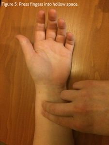 Locate the Radial Artery
