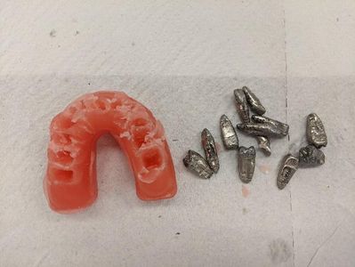 Remove Metal Teeth