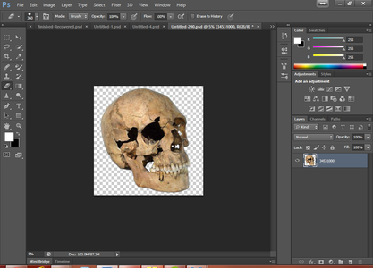 The Skull, Wound and the Spine