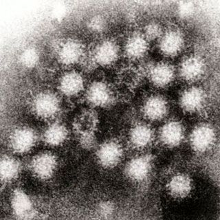 Stomach Flu