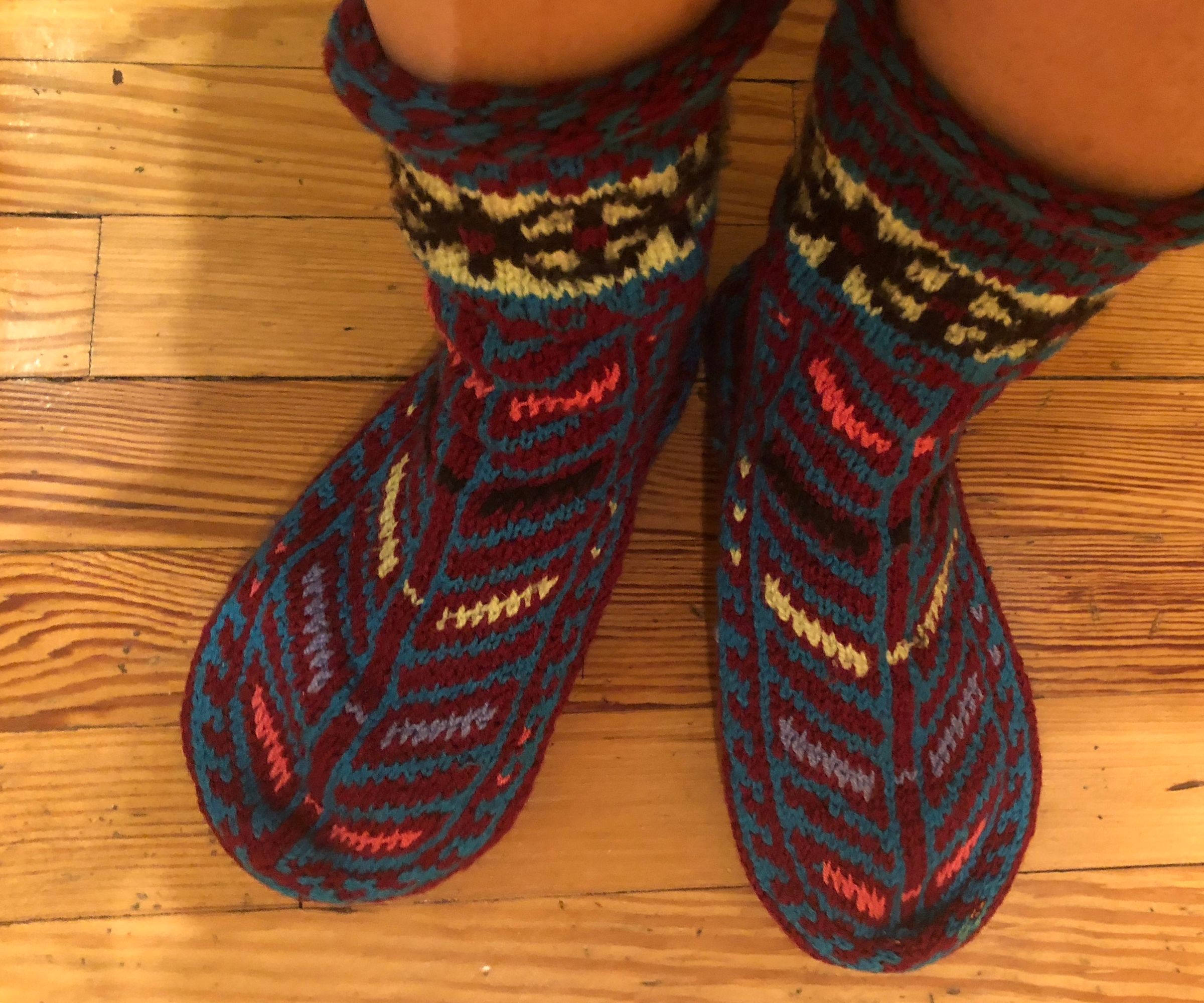 Repairing Holy Wool Slipper Socks w/ Needle Felting