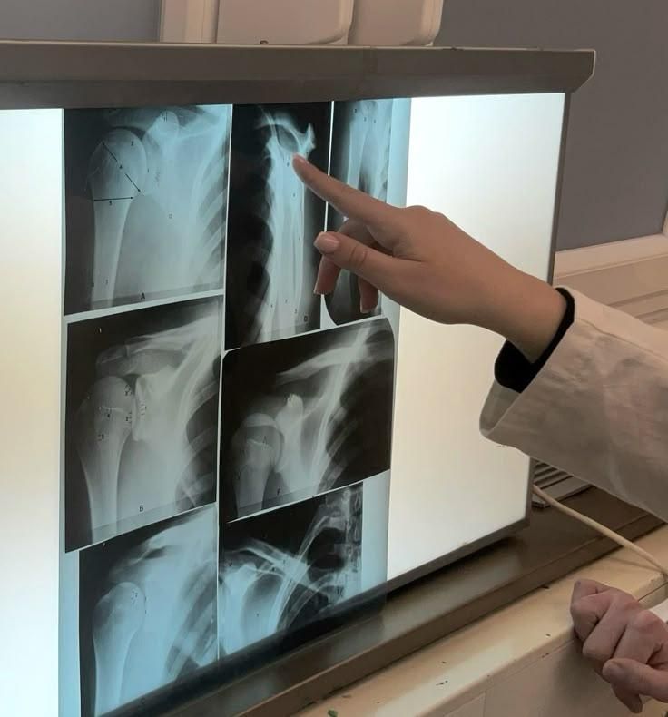 3rd Digit X Ray Routine Steps on How to Take an X-ray : 6 Steps - Instructables
