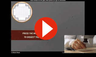 Yeast Tetrad Dissection