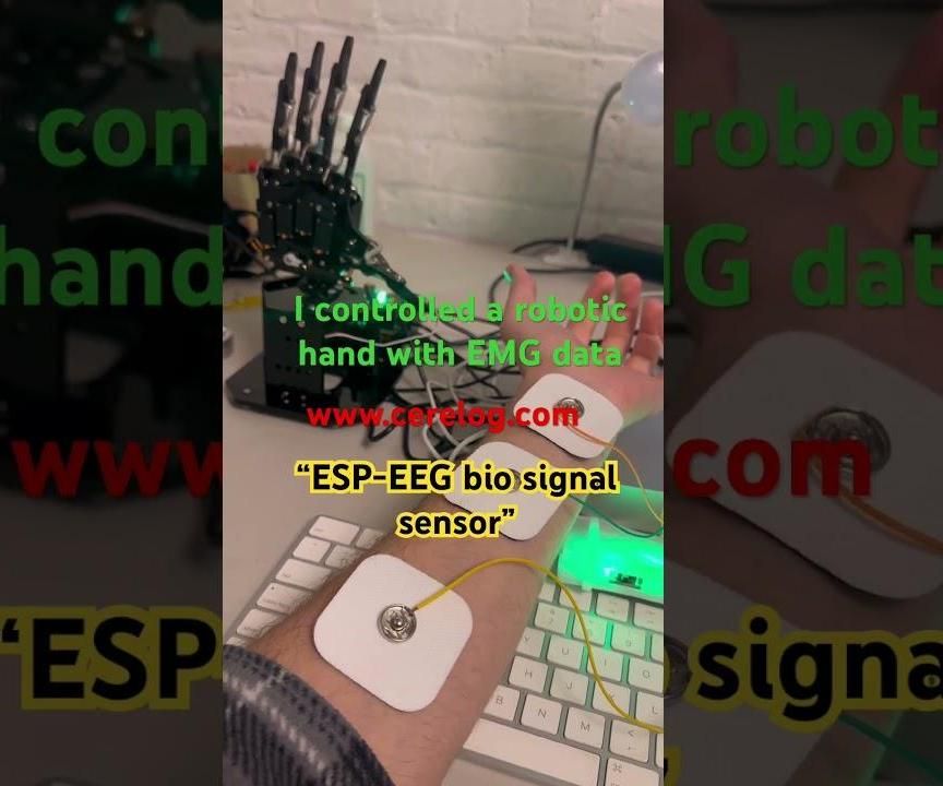 Control a Robotic Hand With Muscles (EMG) and ESP-EEG: the Ultimate Open-Source EMG Interface!