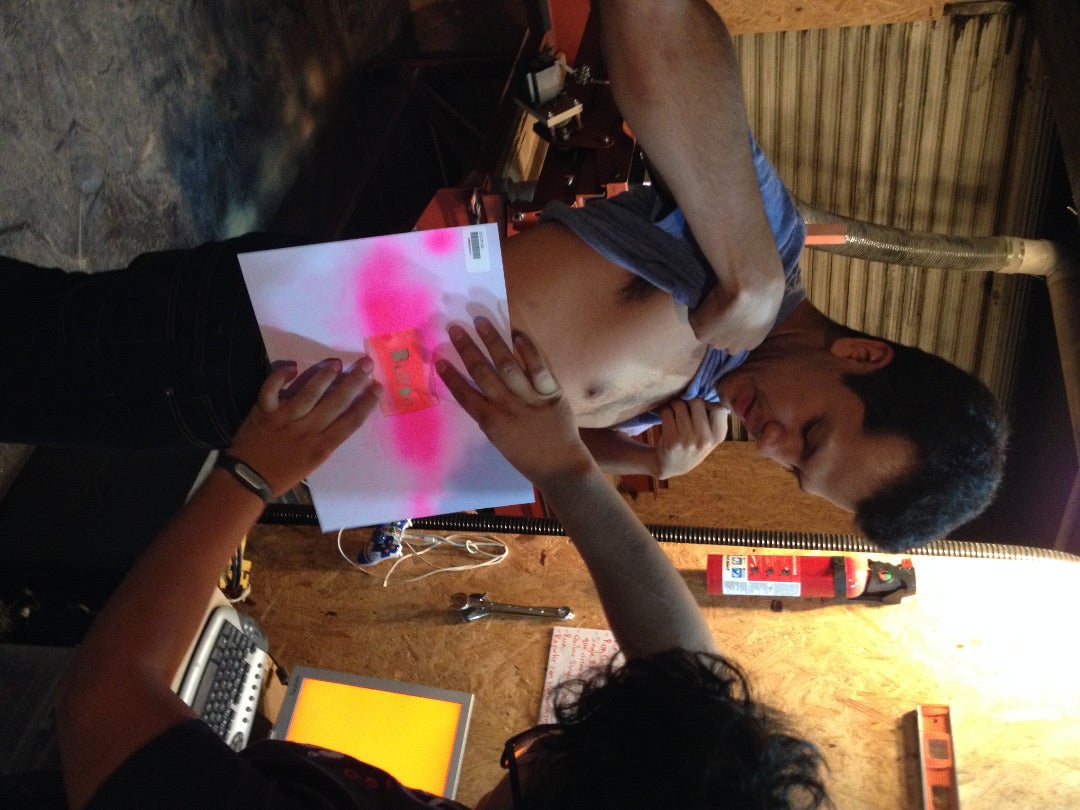 El Abdomen