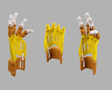 Prothestic Hand : 5 Steps (with Pictures) - Instructables
